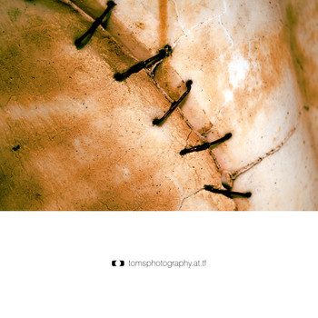 Heilungsprozess
