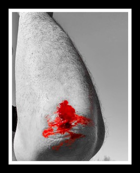 Rot
