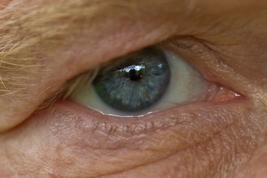 Im Auge des Betrachters
