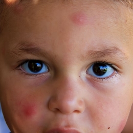 Kinderaugen